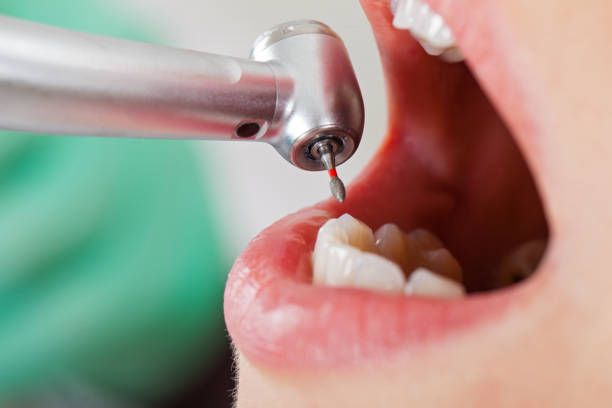 Best Teeth Whitening  in Ball, LA